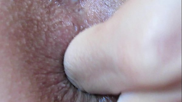 Anus Normal E Anus De Quem Prática Sexo Anal